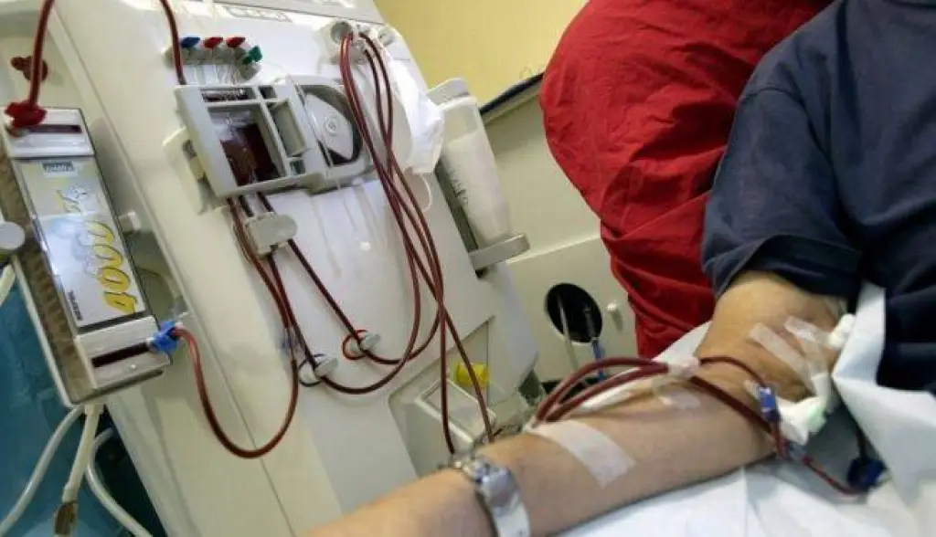 بين غزة وبرشلونة: لاجئة من فلسطين تبحث عن علاج لسرطان البنكرياس